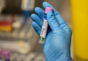 Mpox sample